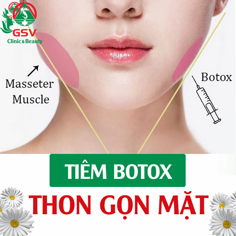 Tiem Botox Thon Gon Guong Mat