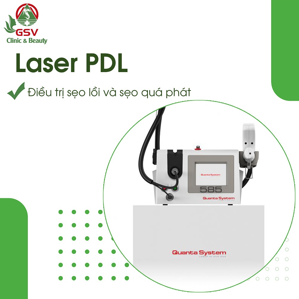 cách trị sẹo bằng laser PDL