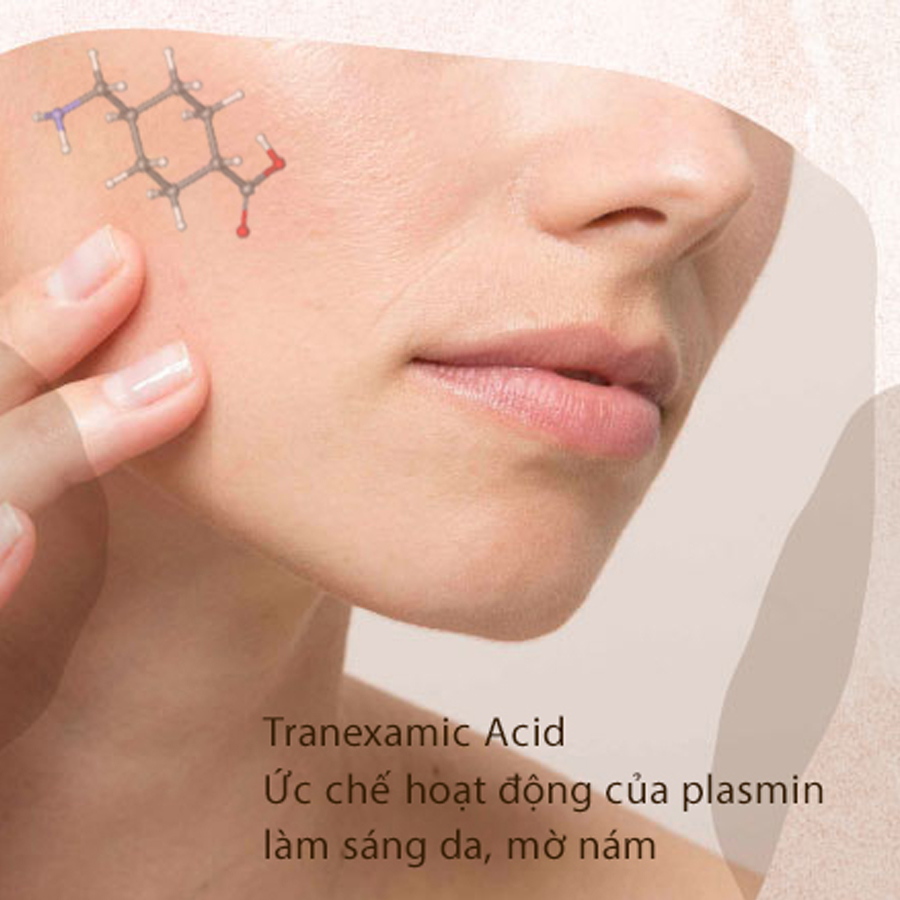 Dieu Tri Nam Bang Tiem Acid Tranexamic 2