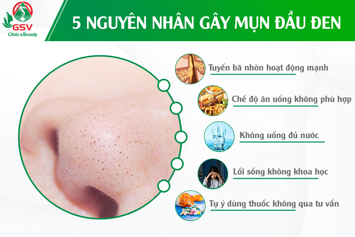 Mun Dau Den Nguyen Nhan Va Cach Dieu Tri (2)