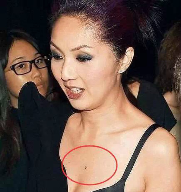 Nốt ruồi ở ngực trái của phụ nữ nói lên điều gì?