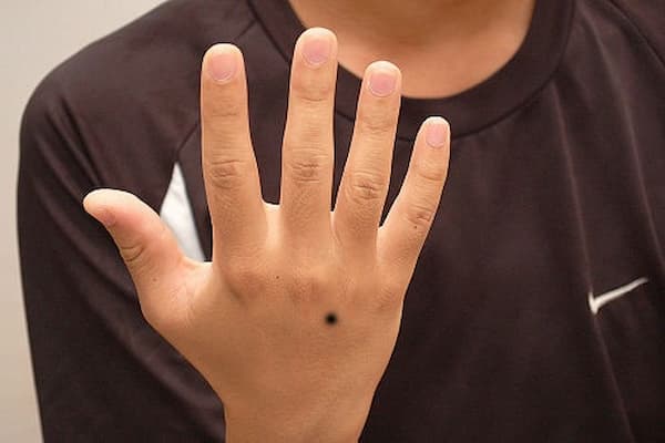 Nam giới trên mu bàn tay trái có nốt ruồi thường tham vọng nhưng kém may mắn