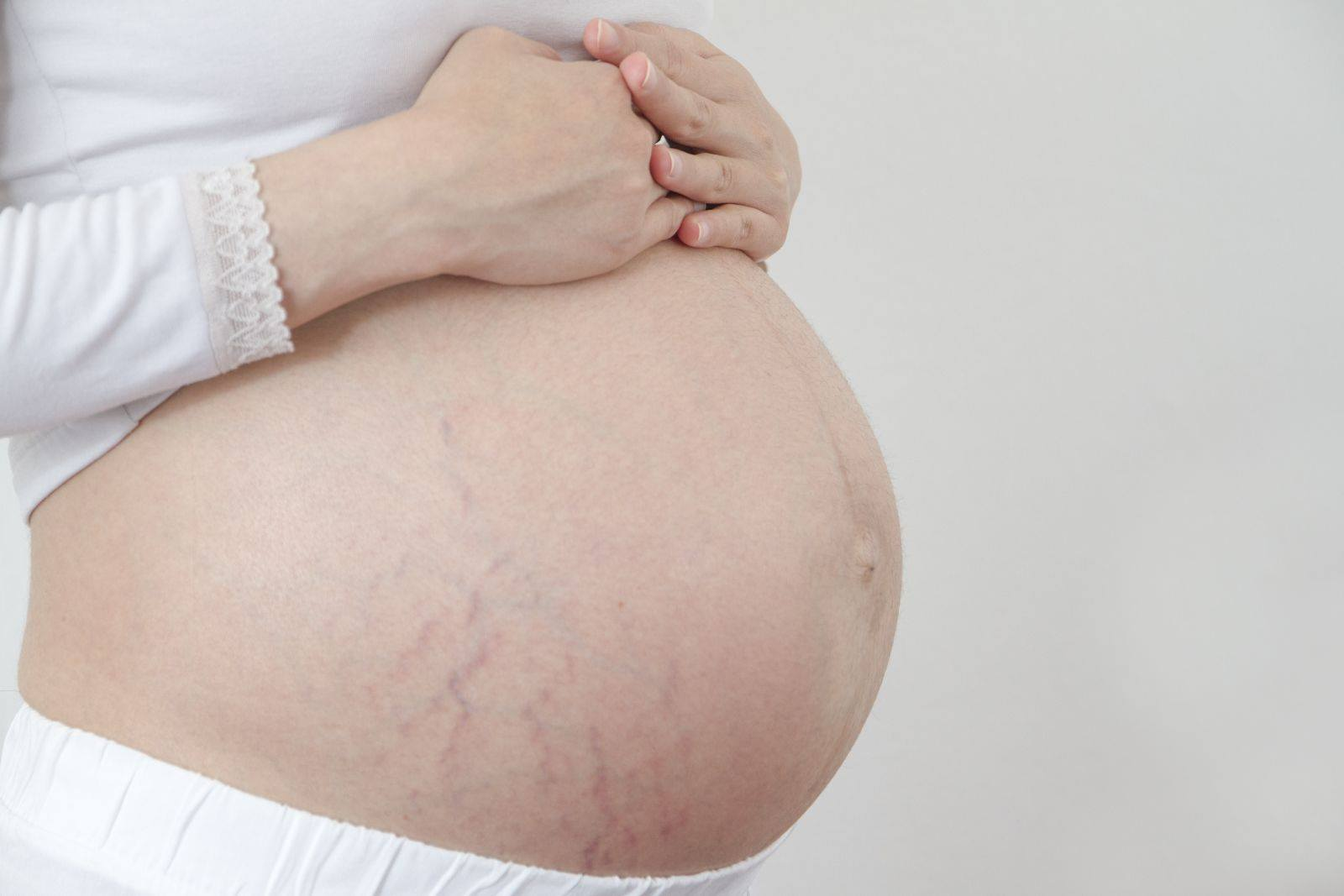 Mỡ trăn có khả năng trị rạn da cho phụ nữ mang thai